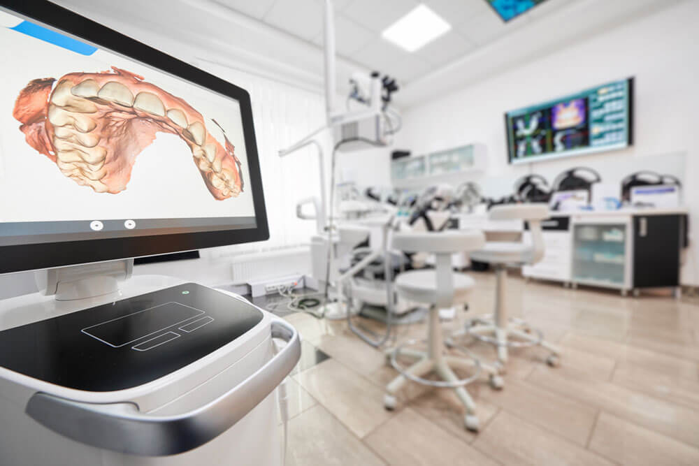 Computer screen with high precision digital jaw print on it