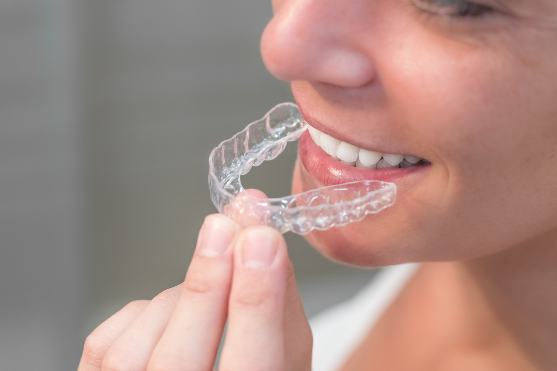 Woman wearing invisible braces aligner