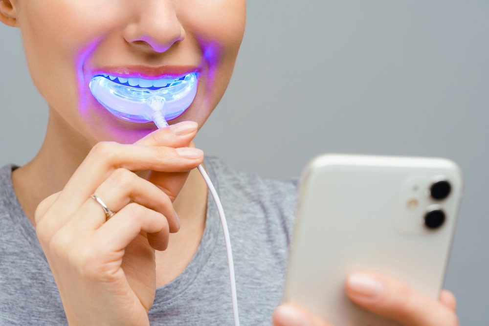 DIY Dental Treatments