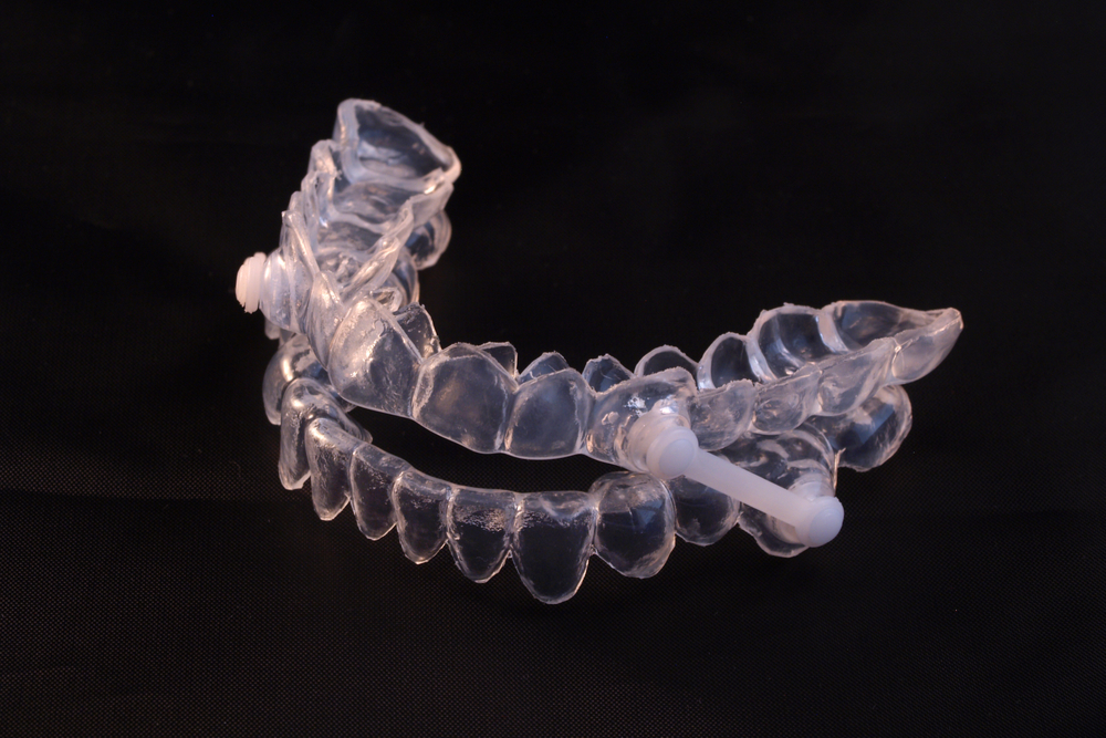 aligners